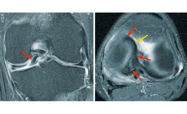 KS531P61.jpg