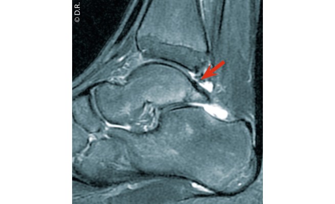 KS538P61.jpg