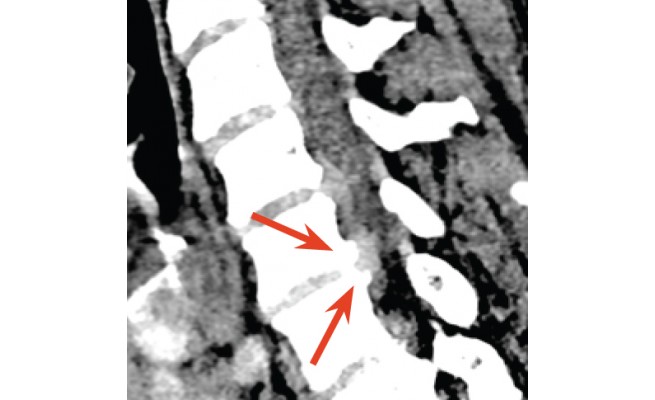 KS576P63.jpg