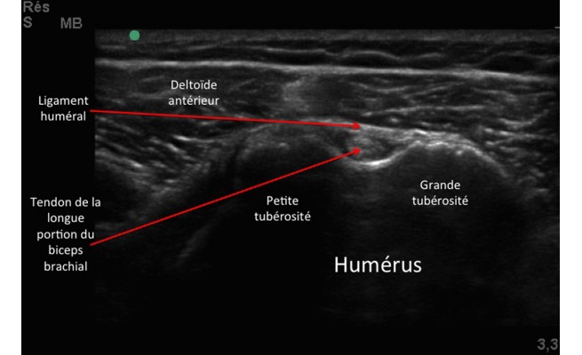 KS582P44.jpg