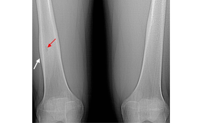KS585P63.jpg