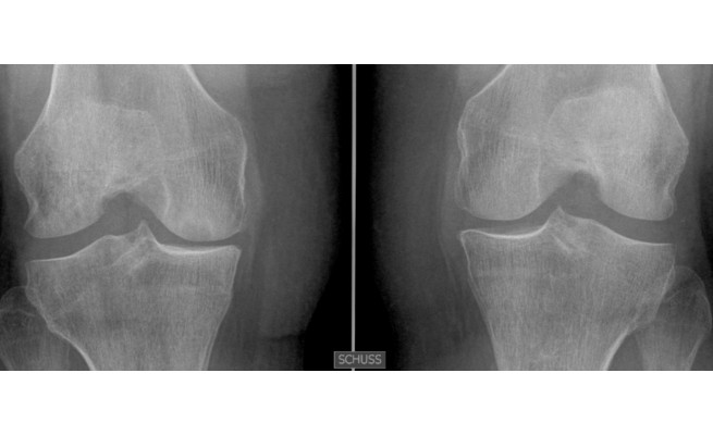 KS588P63.jpg
