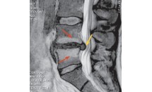 KS593P13.jpg