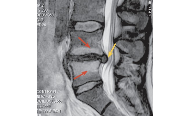 KS593P13.jpg