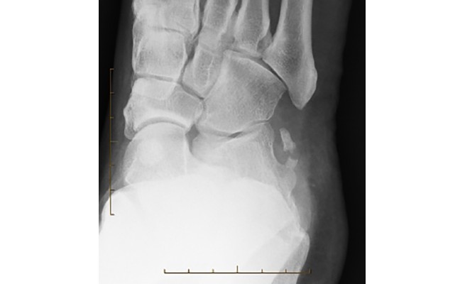 KS593P63.jpg