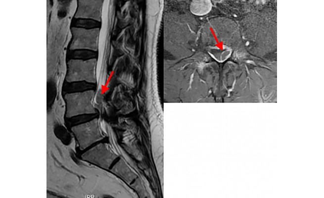 KS595P63.jpg