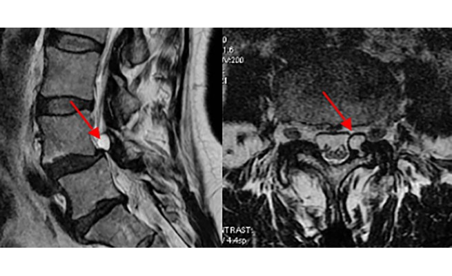 KS596P61.jpg