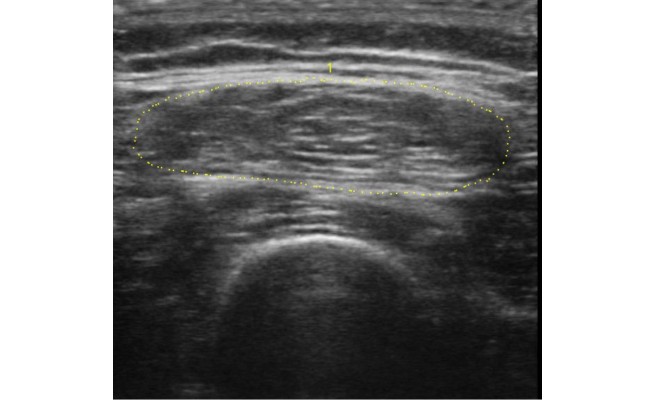 KS633P45.jpg
