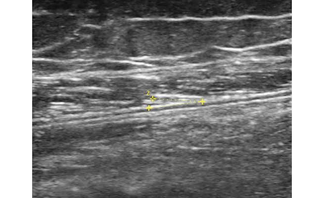 KS645P43.jpg