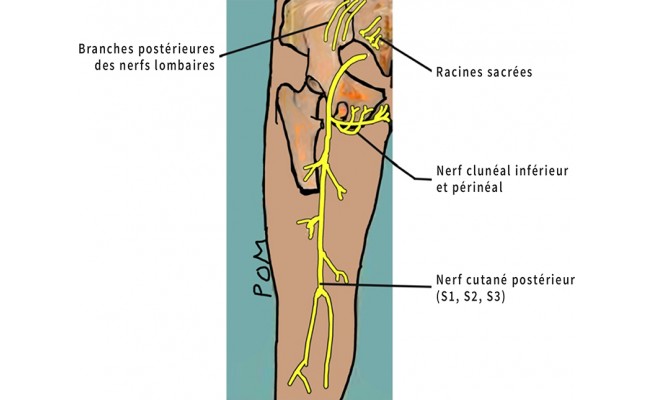 Ks - Diagnostic kinésithérapique d'une névralgie clunéale ...