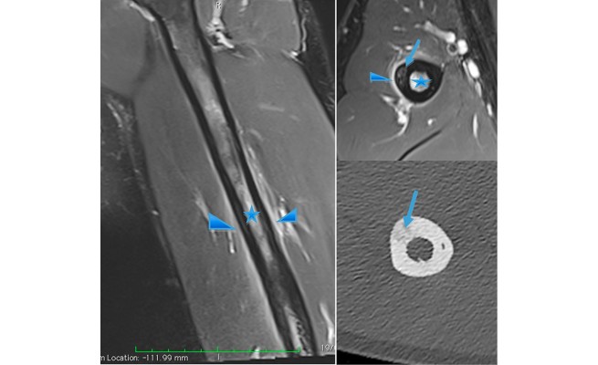KS663P79.jpg