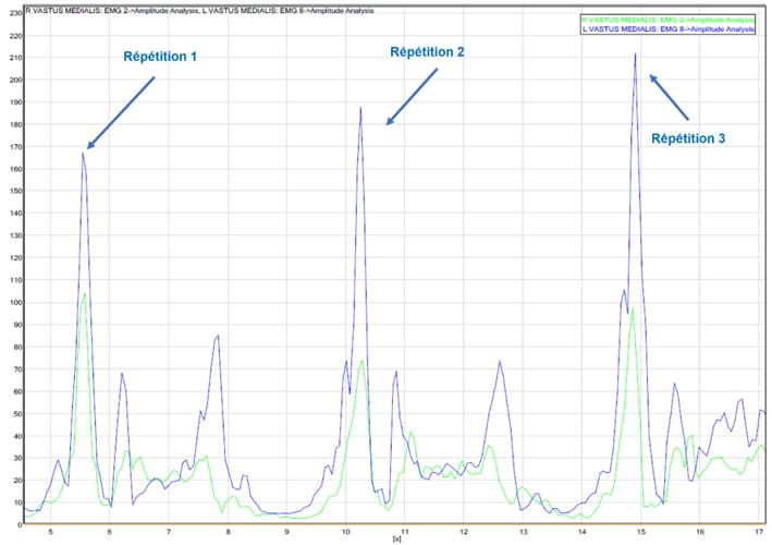 Intérêt de l'électromyographie de surface (EMG-S) dans la rééducation du sportif blessé : la pratique quotidienne