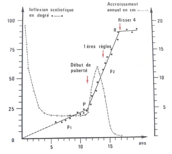 La place de la kinésithérapie dans le traitement des scolioses idiopathiques de l'adolescent : biomécanique et stratégies sensorielles