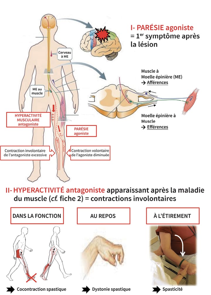 L'approche éducative du thérapeute dans l'application des contrats d'autorééducation guidés