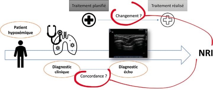 L'échographie thoracique influence la décision clinique du MK une analyse d'article