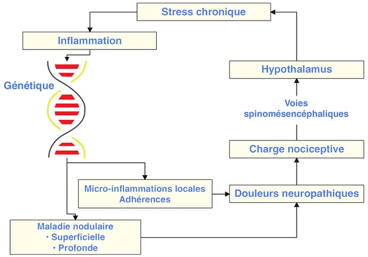 Endométriose, ovaires polykystiques et congestion veineuse pelvienne, 3 maladies inflammatoires pelvi-périnéales approche originale