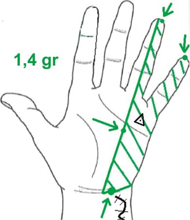 Méthode de rééduction sensitive de la douleur : une alternative de rééducation-réadaptation qui a fait ses preuves