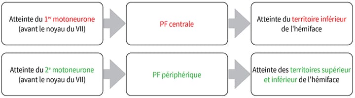 Paralysies faciales points essentiels à connaître par le kinésithérapeute