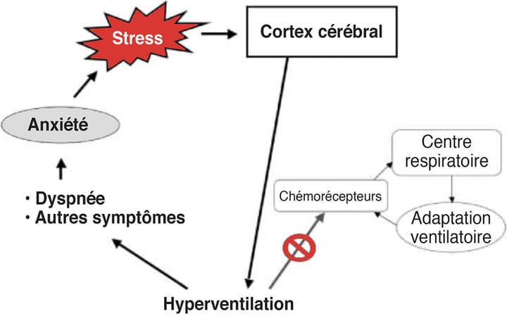Le kinésithérapeute, acteur clé de la prise en charge du syndrome d'hyperventilation