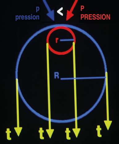 Pression de travail sous bandage de décongestion : oui, mais laquelle ?