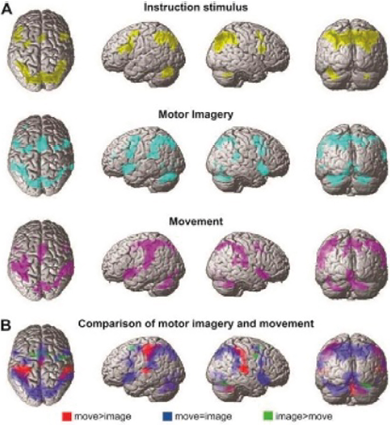 Innover dans la prise en charge de la spasticité avec un procédé non invasif