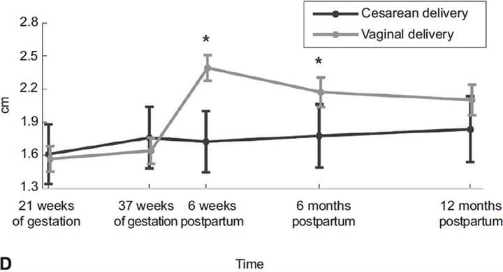 Utilisation de l'échographie chez la femme en post-partum