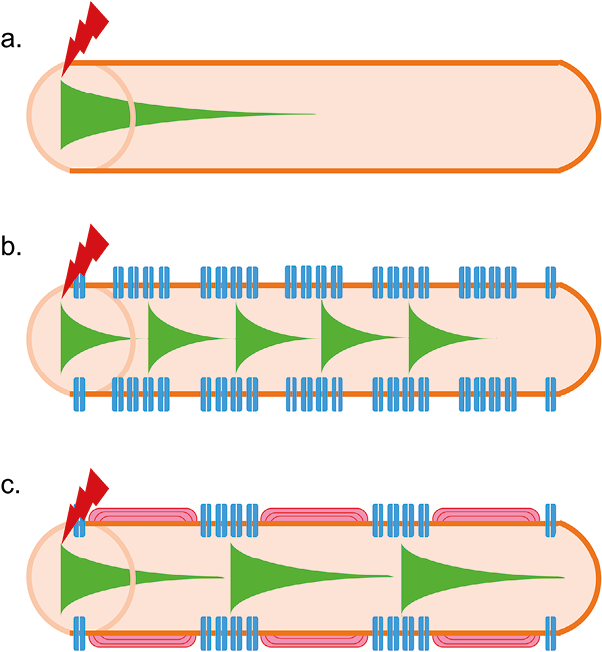 Sclérose en plaques et le High Intensity Interval Training (HIIT)