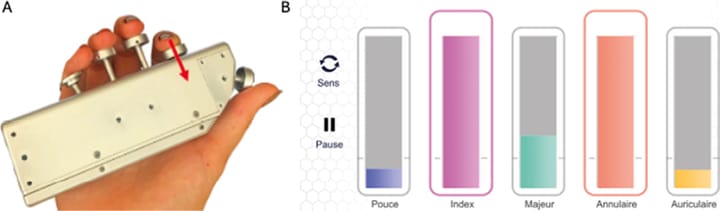 Mécanismes sensoriels de la récupération de la dextérité manuelle après AVC : protocole d'une étude de cohorte prospective pour prédire la récupération motrice du membre supérieur et spécifier les corrélats cérébraux
