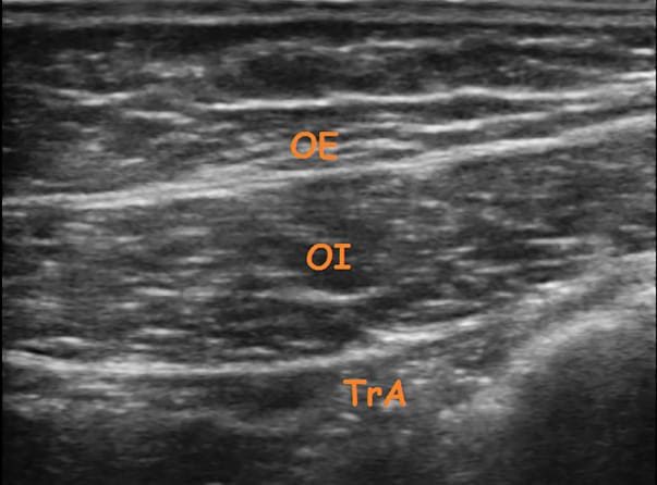Intérêt de l'échographie en pelvi-périnéologie
