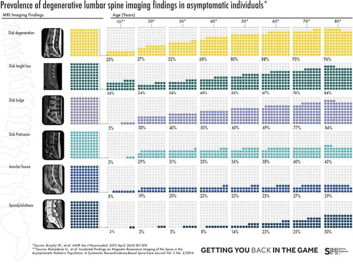 Quelle correspondance entre le complexe pied-cheville et le lombalgique chronique ?
