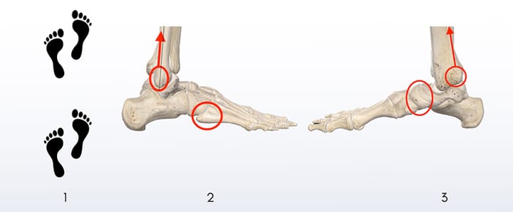 Examen clinique et prise en charge de l'entorse récente de cheville 1. Accès direct et parcours de soins actualisés