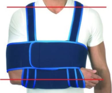 Séance de kinésithérapie préopératoire dans le cadre du protocole RAAC de la chirurgie de la coiffe des rotateurs