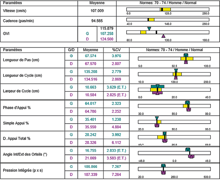 L'analyse fonctionnelle de la marche vers une véritable utilisation clinique des paramètres spatio-temporels