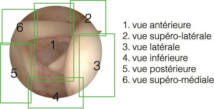 Anatomie : l'articulation gléno-humérale