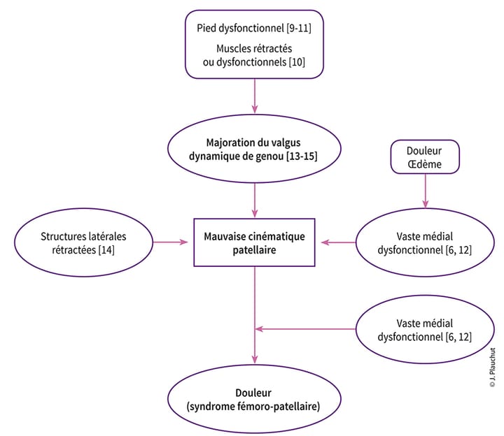 Existe-t-il un lien entre le syndrome fémoro-patellaire et le déficit de flexion dorsale de la cheville ?