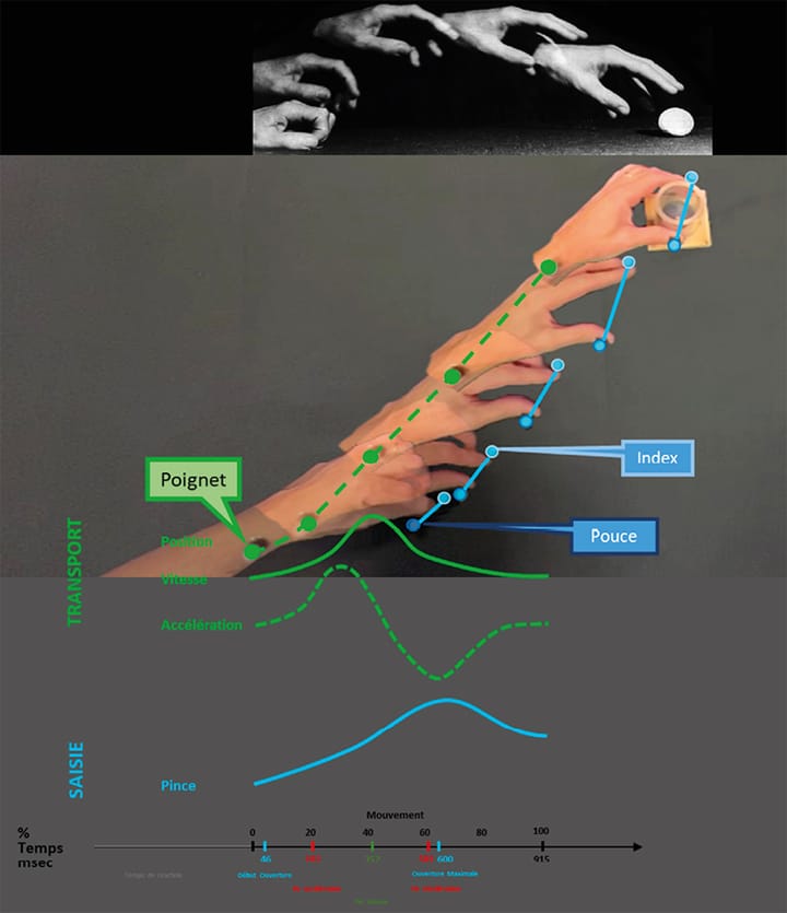 L'analyse quantifiée du mouvement du membre supérieur à l'aide d'un geste écologique standardisé : intérêts cliniques ?