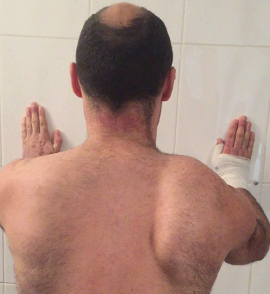 Bilan-diagnostic kinésithérapique de l'épaule douloureuse