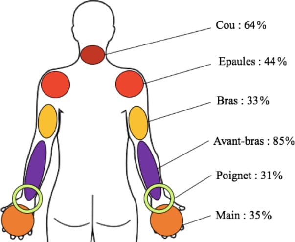 Troubles musculo-squelettiques chez le pianiste