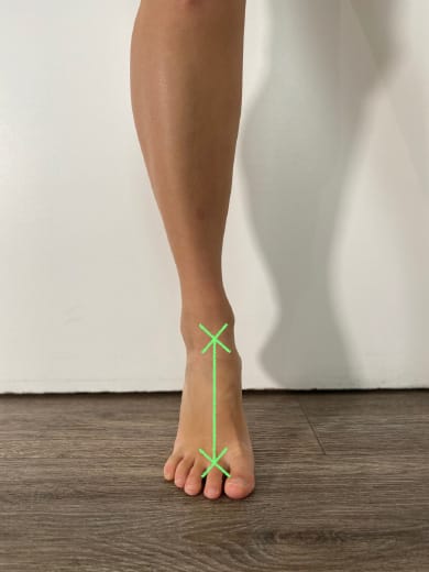 Proposition d'un protocole en 4 étapes de rééducation des tendinopathies d'Achille