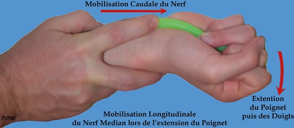 Validation des techniques de mobilisations neurovasculaires (neurodynamiques ou neuroméningées) 1ère partie : le membre supérieur