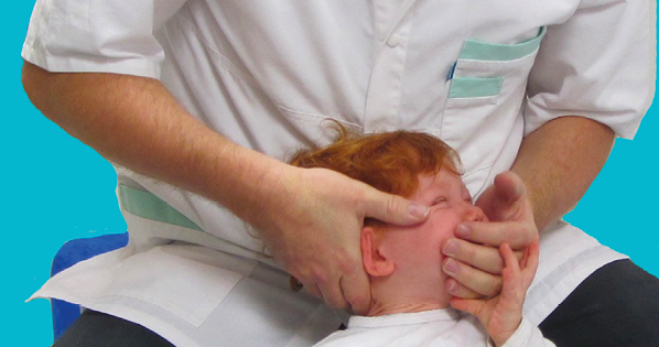 Efficacité de la thérapie manuelle cervicale chez le nourrisson dans les plagiocéphalies posturales