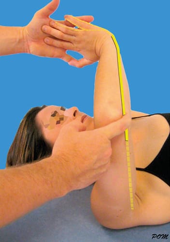 Tests cliniques pour un syndrome du nerf ulnaire au coude