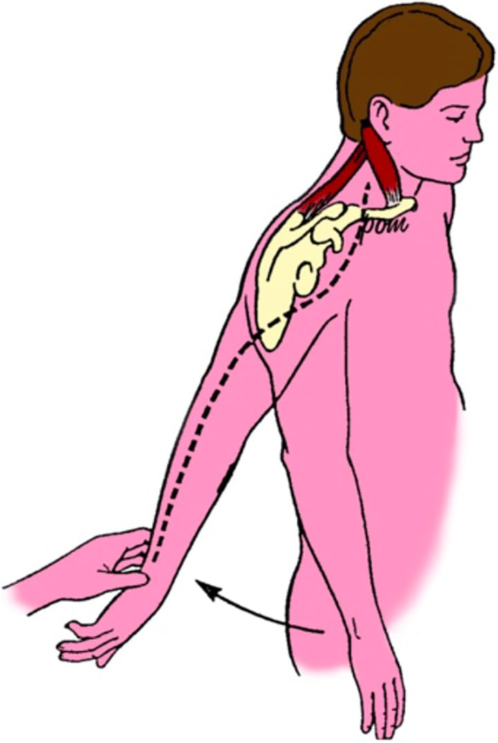 Diagnostic du syndrome scapulo-costal