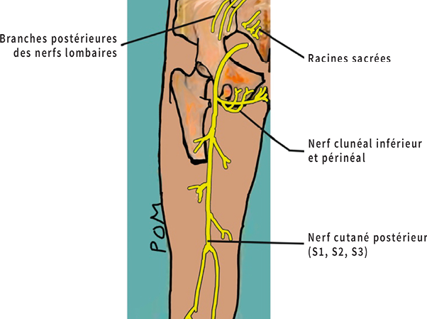 Diagnostic kinésithérapique d'une névralgie clunéale (syndrome des nerfs cluniaux inférieurs) (1ère partie)