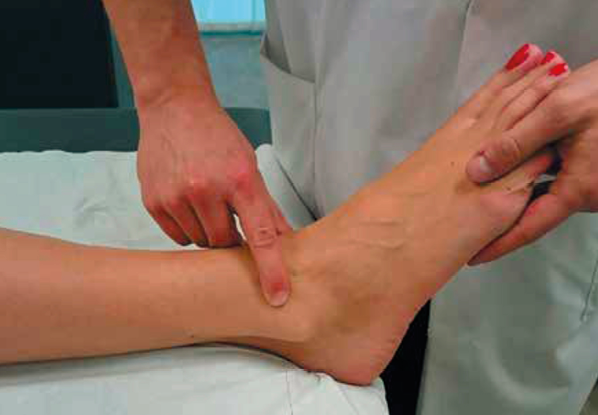 Proposition d'un nouveau regard à propos de l'atteinte de la syndesmose tibio-fibulaire par élongation du ligament tibio-fibulaire antéro-inférieur lors de la survenue d'une entorse de cheville