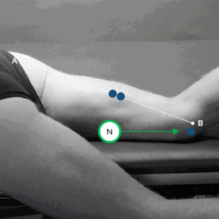 Intérêt de l'électromyographie de surface (EMG-S) dans la rééducation du sportif blessé : partie I : installation, application, analyse et interprétation