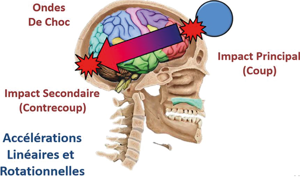 Gestion de la commotion cérébrale du terrain au cabinet, et du cabinet au terrain
