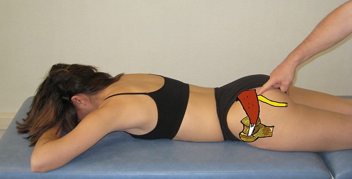 Validation des techniques de mobilisations neurovasculaires (neurodynamiques ou neuroméningées) 2ème partie : le membre inférieur