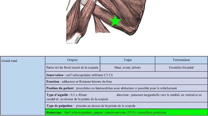 Efficacité de la puncture kinésithérapique dry needling (DN) / pathologie (2e partie)