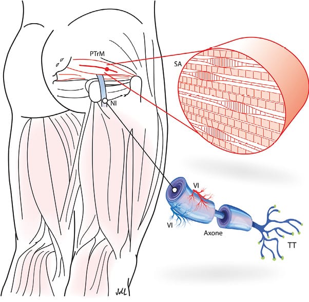 Syndromes pelviens myofasciaux : prise en charge en thérapie manuelle bases théoriques (2e partie)